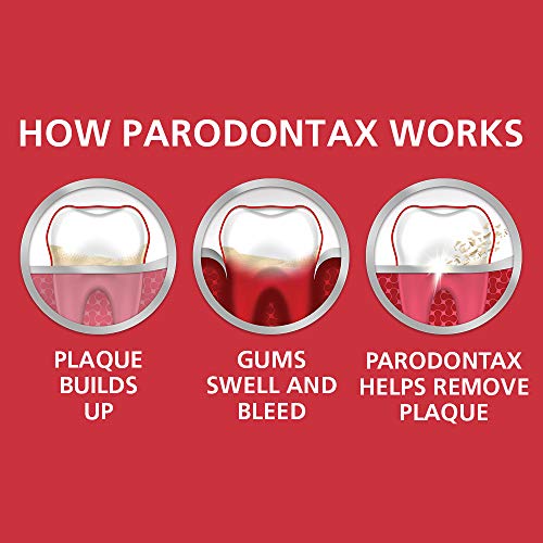 Toothpaste for Bleeding Gums and Cavity Prevention, Extra Fresh E93760