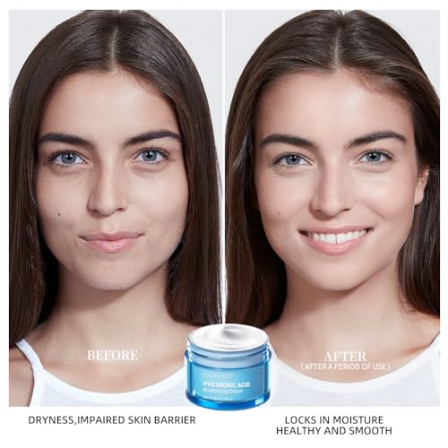 Hyaluronic Acid Moisturizing Water Gel for Oily Skin, 1.76 oz F514
