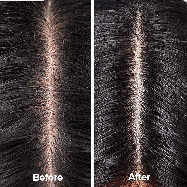 Scalp Therapy Shampoo for Dry, Oily and Sensitive Scalps N994