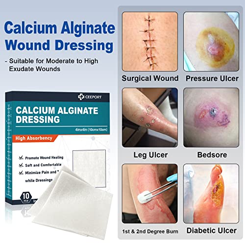 Silver Calcium Alginate Wound Dressing Pads, 4x4, 10 Pack L395